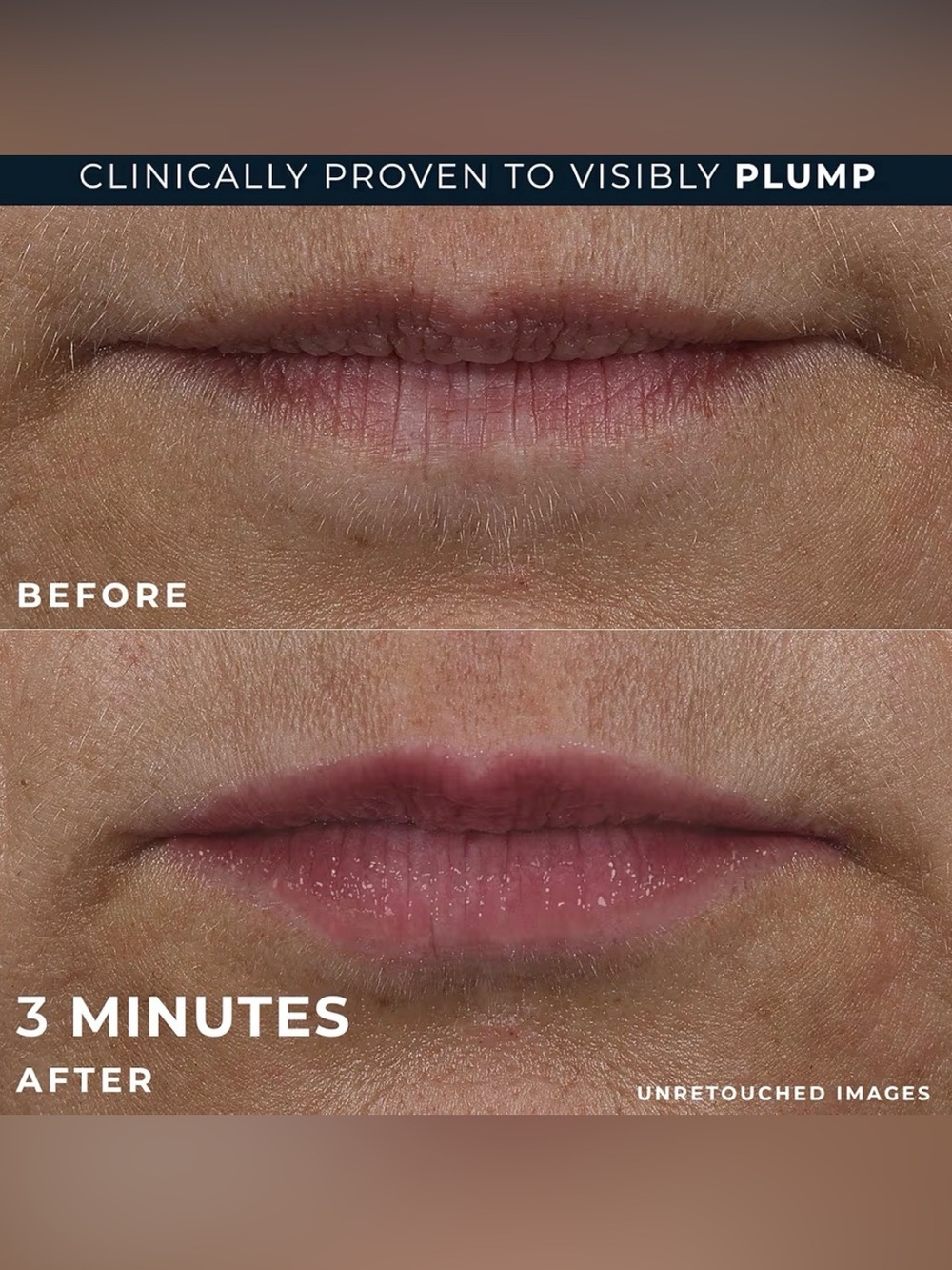 RoC Lip Volumizer Treatment Collagen Peptides + Hyalauronic Acid | NEW - Picture 4 of 7